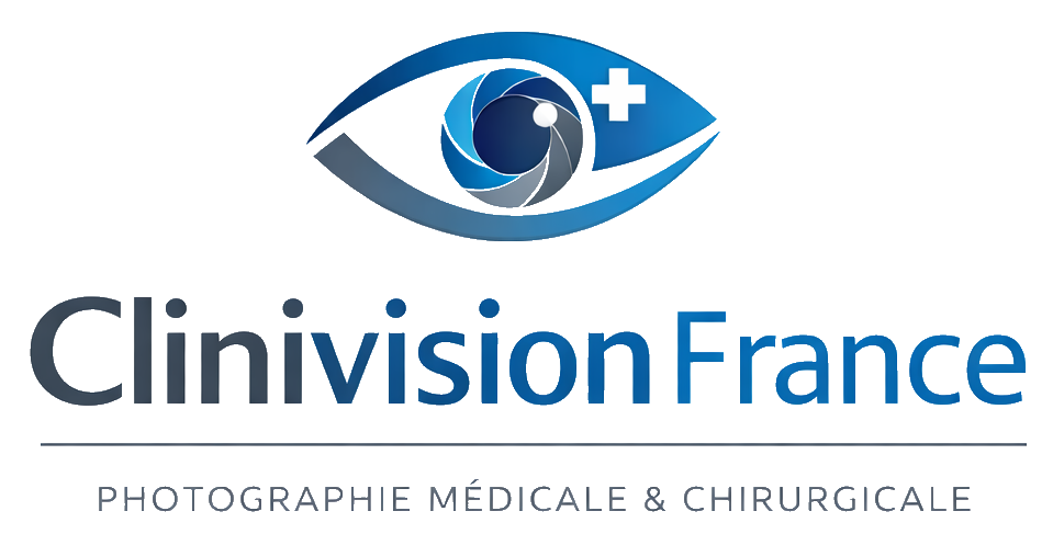 clinivision